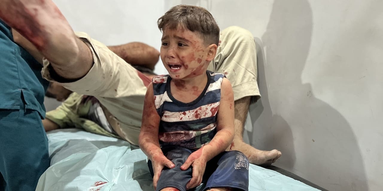 gazzede 15 binden fazla hasta yardim bekliyor URSp2qQq