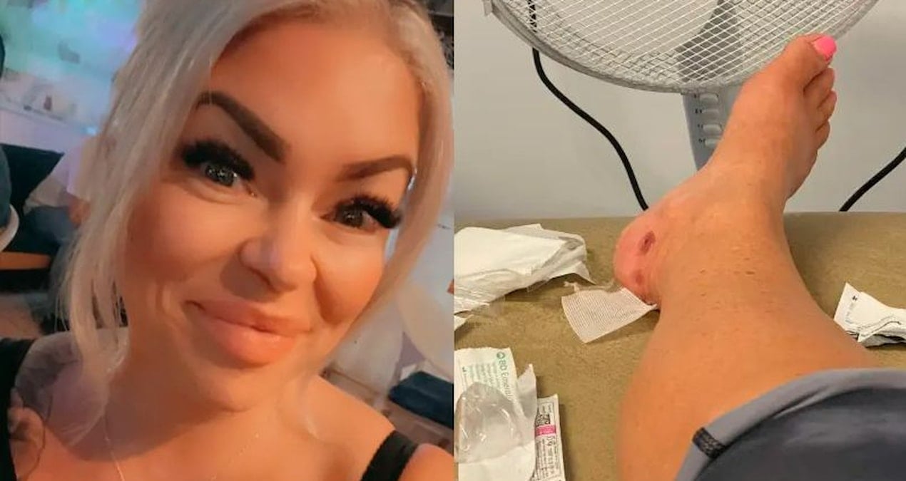 ingiliz kadinin bodrumdaki luks otelde yaptigi tatil ulkesine donunce kabusa dondu HCmln8qk.jpg